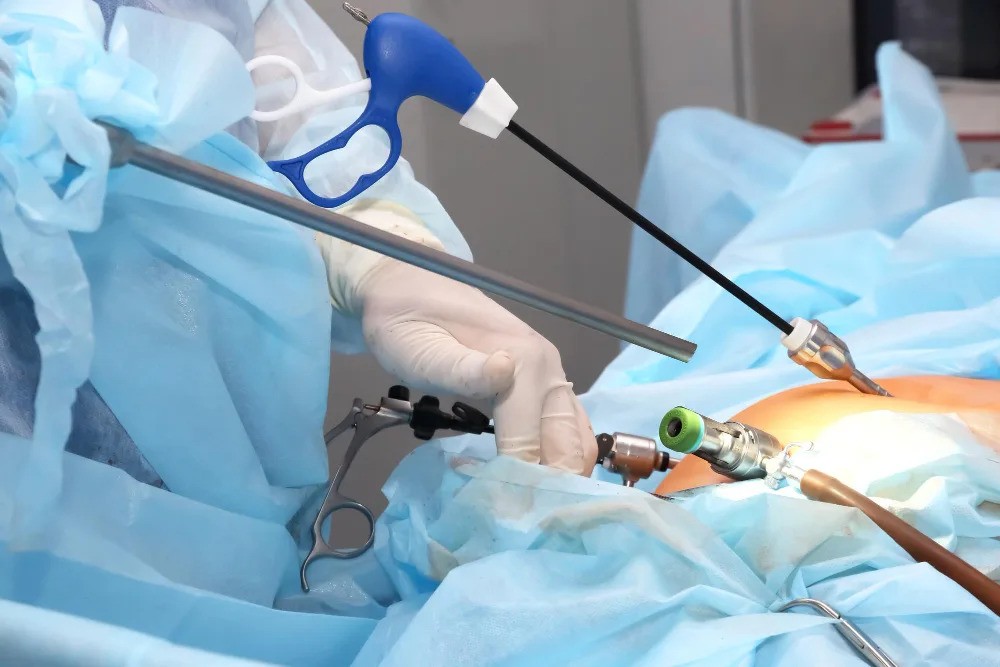 laproscopic-surgery-in-islamabad