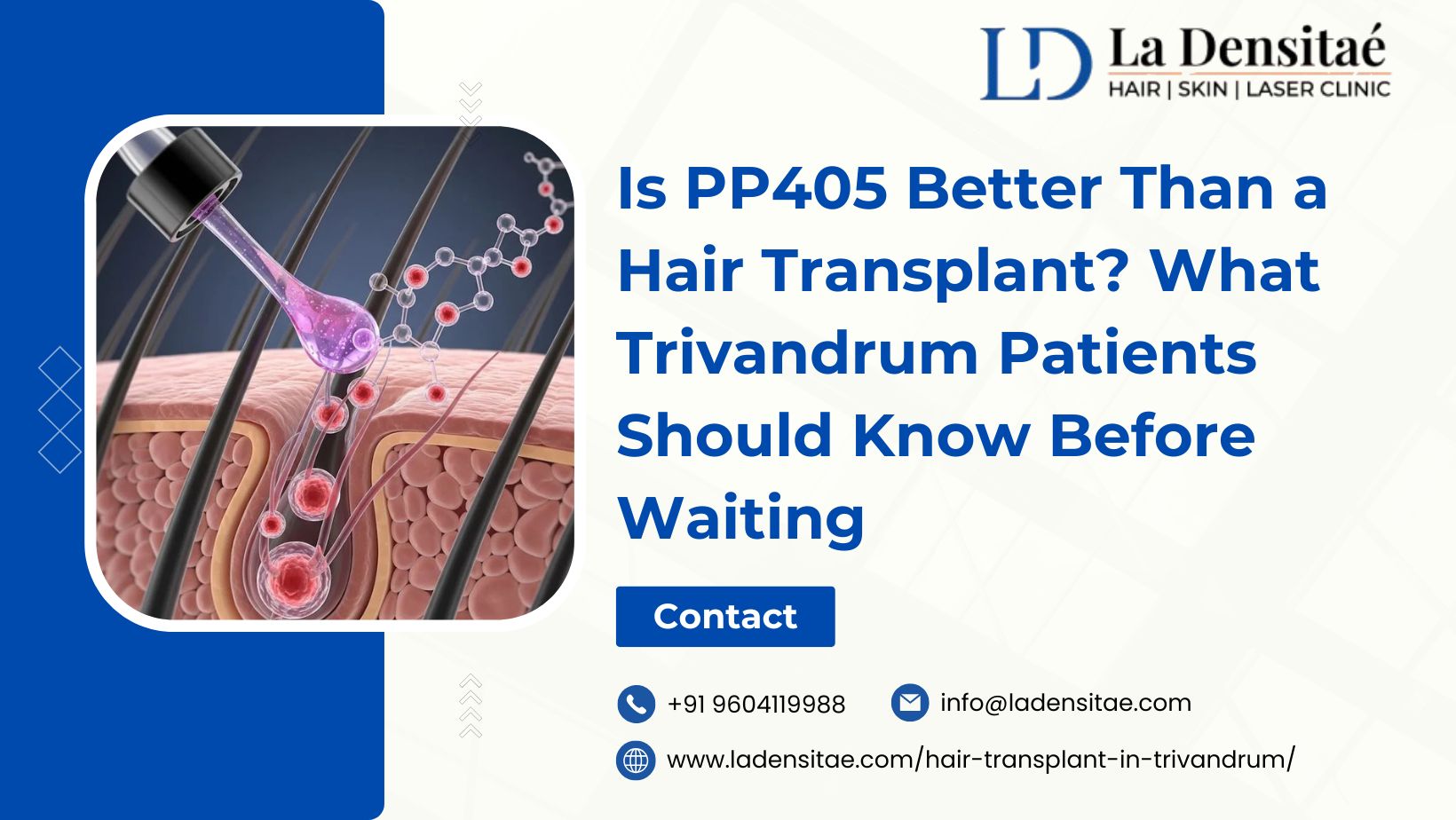 Is-PP405-Better-Than-a-Hair-Transplant-What-Trivandrum-Patients-Should-Know-Before-Waiting7KG9ihu