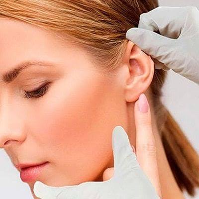 otoplasty-in-Islamabad-4