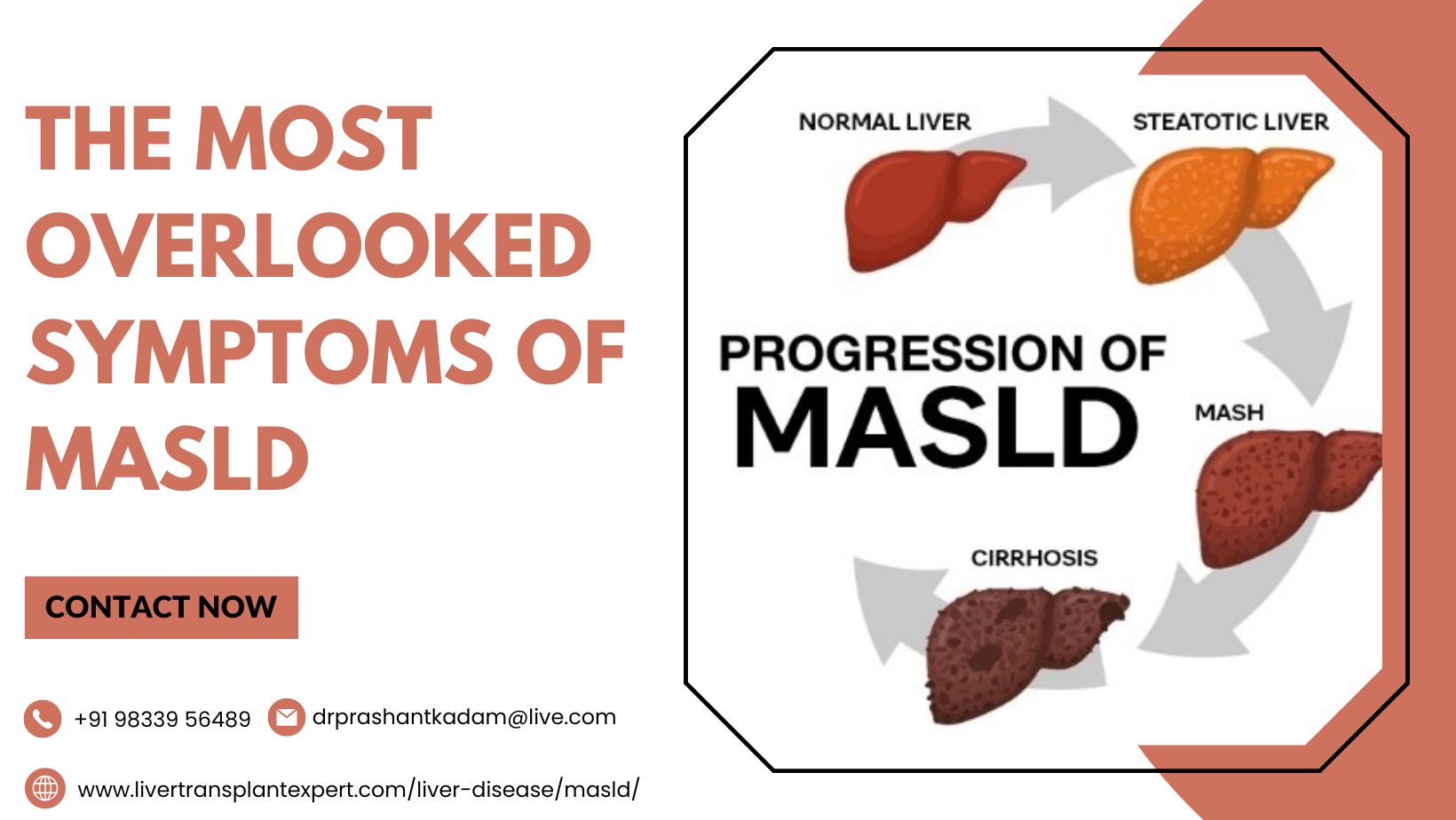 The-Most-Overlooked-Symptoms-of-MASLD7umIj4p