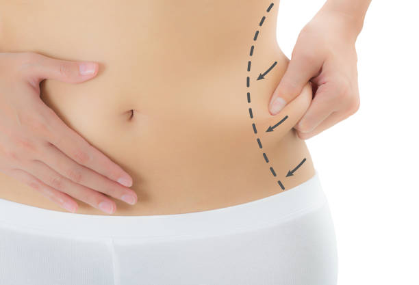 istockphoto-1450907489-612x612