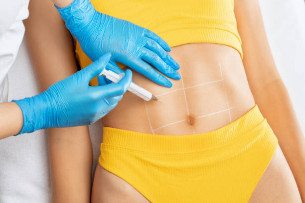 Fat-Melting-Injections-in-Riyadh-24
