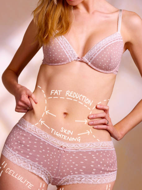 Liposuction-in-Riyadh-15