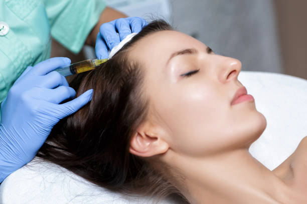 PRP-Hair-Treatment-in-Riyadh-18
